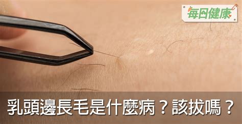 奶頭毛|乳頭邊長了毛，是什麼病？該不該拔？讓名醫一次解釋給您聽｜每